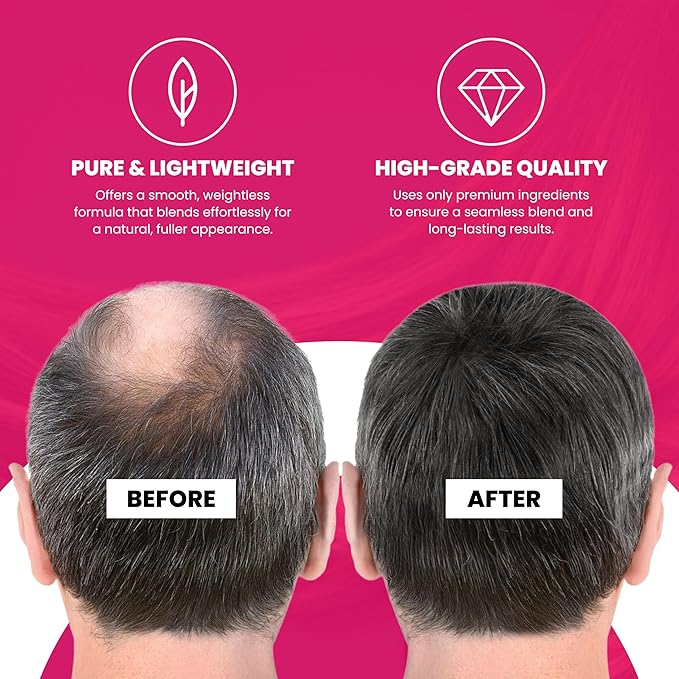 VELO Hairline Powder–RED BROWN Hair Root Touch Up Powder for Women & Men–Instantly Covers Gray Hair, Thinning Hair & Bald Spots–Sweatproof Root Cover Up–Puff & Mirror Compact, 13 Shades