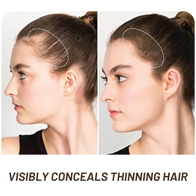 VOLLUCK Root Touch up Powder, Instant Hairline Powder for Thinning Areas and Gray Hair Coverage, Natural and Non-greasy Root Cover up for Women and Men (Medium Brown, 0.35 Ounce)