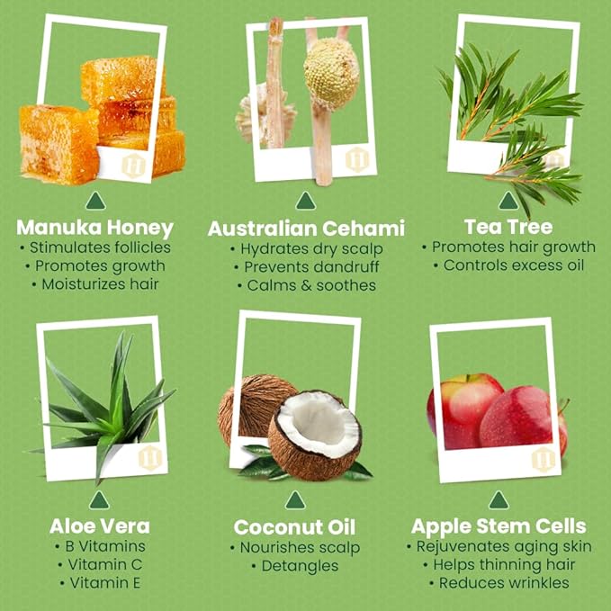 Tea Tree & Honey Shampoo & Conditioner Set - Dandruff Treatment With Organic Tea Tree Oil - Itchy Scalp Treatment for Women & Men - Sulfate and Paraben Free With Manuka Honey Aloe Vera & Coconut (8oz)