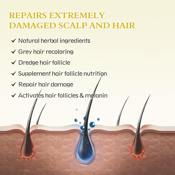 2-Pack 5% Minoxidil Hair Growth Serum, Hair Regrowth Treatment for Men and Women, Strengthens and Thickens Hair for Fuller, Longer Results, Beard and Facial Hair Enhancer