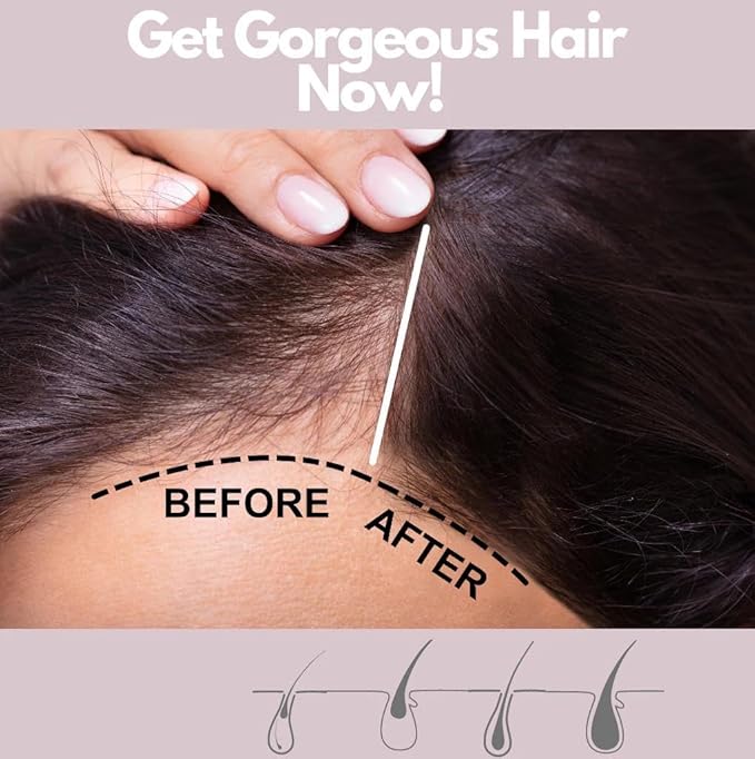 320Pure Hair Vitamin Booster 4oz Spray, Strengthens & Stimulates Hair Growth, Enriched with Vitamins from Garlic, Ginseng, Ginkgo Biloba, & Goji Berry, Pure Extracts for a Healthy, Lustrous Look