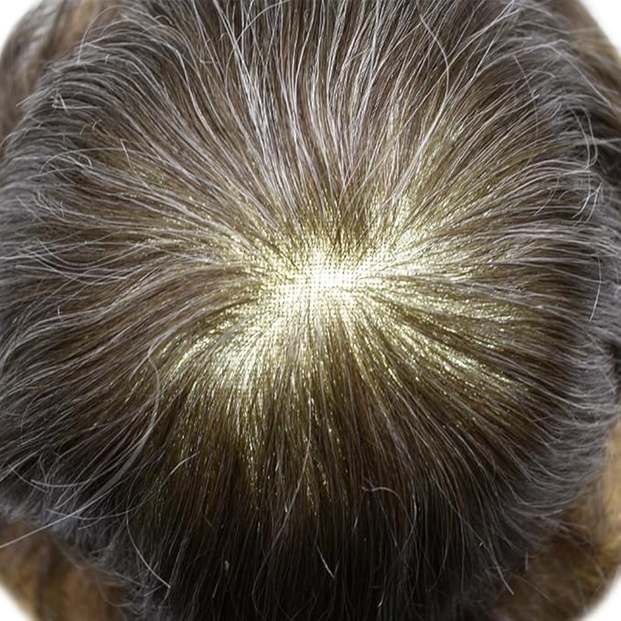 Toupee For Men Real Human Hair System For Men Full Swiss Lace Mens Toupee Lace Hair Piece For Men Hair System Bleached Knots 8x10-80% light density#440 4# MEDIUM BROWN+40% GREY