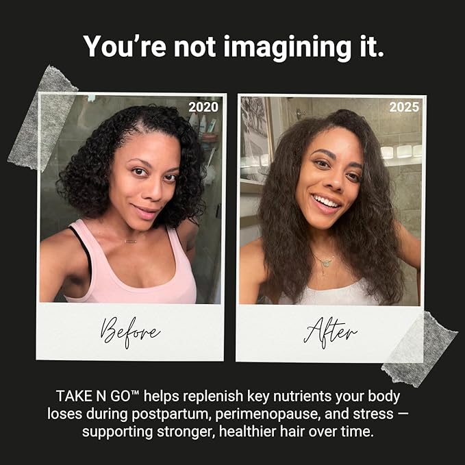 NU Standard TAKE N GO - Hair & Scalp Vitamins - Hair Growth Supplements for Women with 25+ Bioavailable Nutrients, Supports Reduced Shedding & Supports Thicker, Healthier-Looking Hair - 30-Day Supply