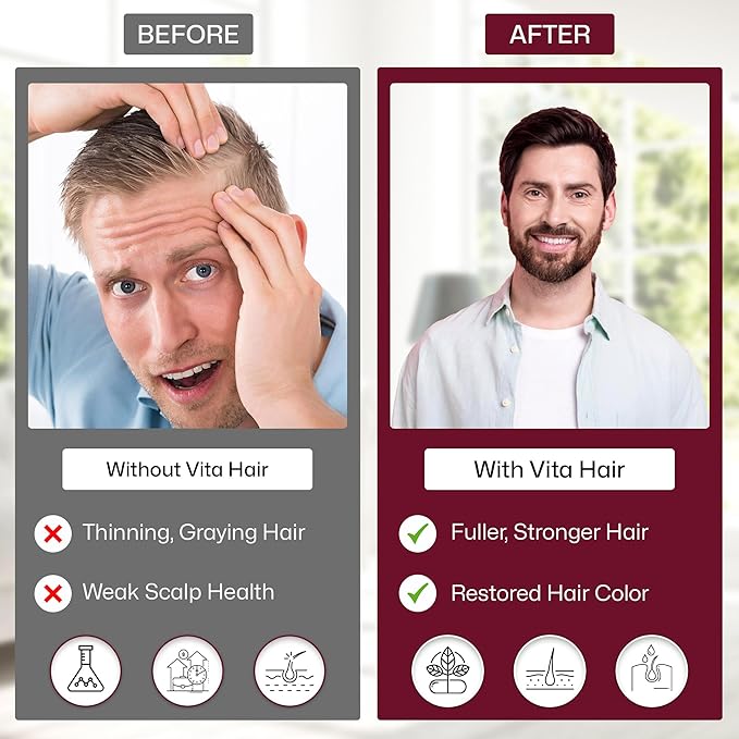 Vita Green Hair Growth Supplement (維新烏絲素) – Herbal Support for Thinning and Graying Hair – Naturally Simulates Follicles to Encourage Fuller, Healthier Hair – 90 Capsules