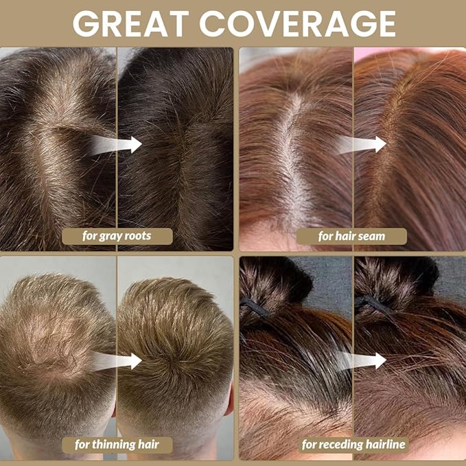 VOLLUCK Root Touch up Powder, Instant Hairline Powder for Thinning Areas and Gray Hair Coverage, Natural and Non-greasy Root Cover up for Women and Men (Medium Brown, 0.14 Ounce)