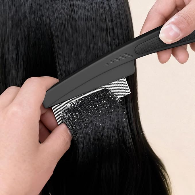 Dandruff Comb 2PC Upgraded Fine Tooth Scalp Detox Comb Lice for Women, Men & Kids Scalp Detoxing, Sweep & Massage Hair Brush Tool with Elegant Box for Hair Care (Brown)