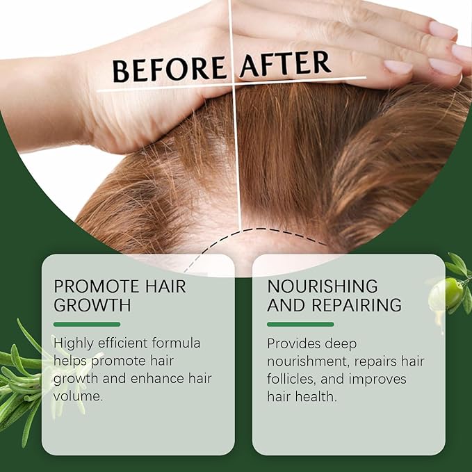 | Biotin | Hair Growth Supplement | Skin Care | Rosemary Hair Growth Essential Oil Promotes Healthy and Nourishing Hair Growth, Tough Hair Essential Oil Hair， (3.38 Fl Oz)