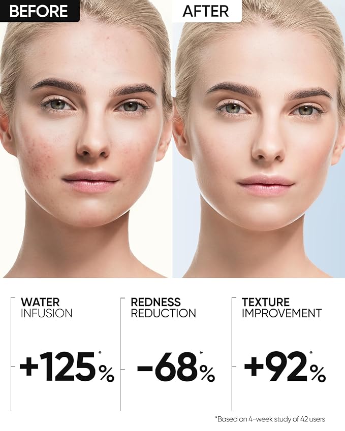 Truffle Biome Skin Cream Gel Moisturizer, Gel & Bubble Layers with White Truffle, Ceramide & Probiotic Complex, Calms Sensitive Skin, Reduces Redness, Strengthens Skin Barrier, 1fl.oz / 30g