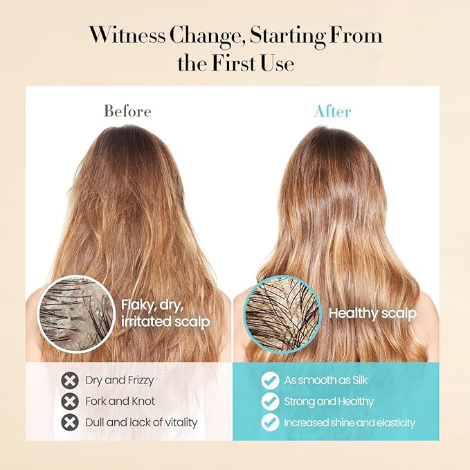 Hair Mask, Deep Conditioning Hair Mask, Hydrating Detangler Moisturizing Dermatologist-Developed Treatment for Curly, Dry, Frizzy, Swimmer's Hair & Itchy Scalp – 5.5 oz