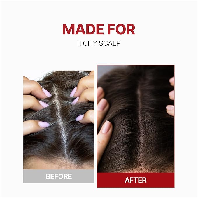 KUNDAL Shampoo/Conditioner + Caffeine Scalp Tonic Set, Sulfate Free Moisture Care, Hair Loss Scalp Strengthening, Korean Hair Care + Amber Vanilla, 16.9 fl oz x2 + 3.38 fl oz