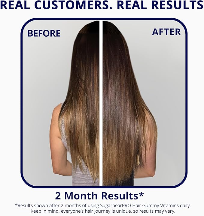 SugarBearPro Hair Vitamin Gummy 6 Month Supply Extra Strength Biotin 6000mcg, Growth for Men & Women, Vegan Vitamin B12, MSM, Inositol, Omega 3, Elderberry, Certified Kosher, Halal, Cruelty-Free