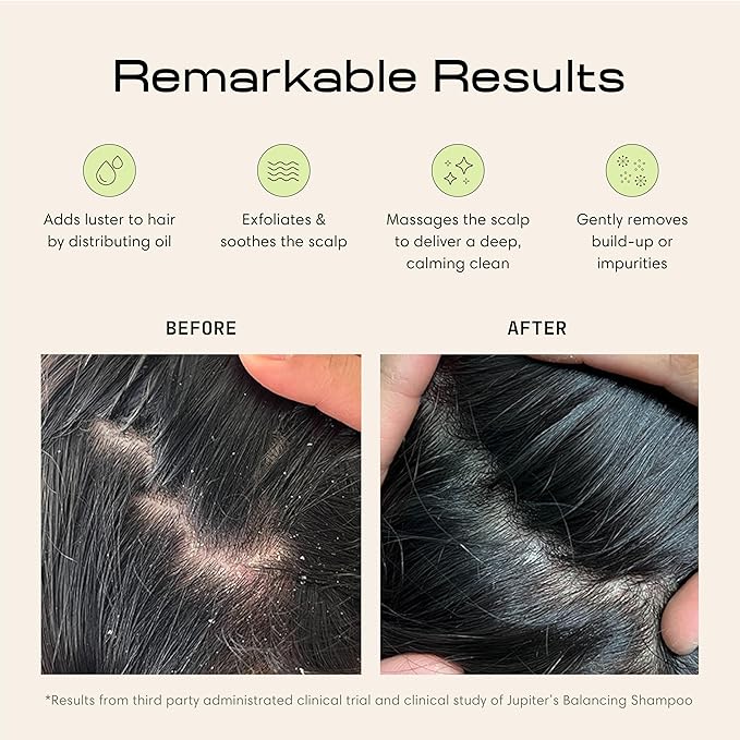 Jupiter Scalp Exfoliator - Scalp Massager Tool for Wet & Dry Hair - Ergonomic Detangler Brush - Dandruff Comb & Scrub to Remove Dandruff & Buildup and Support Circulation - 2 Pack, Black