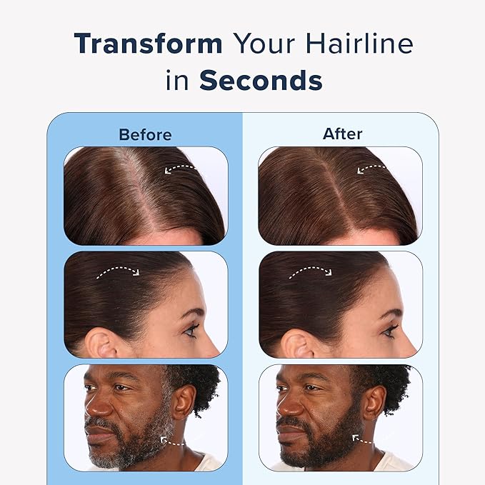 TRUHAIR Color & Conceal Waterproof Root Touch Up Hair Color Concealer - Hair Cover up for Gray Coverage and Hairline Filling - 11 Hair Colors Available (Red)