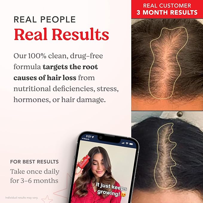 HAIRtamin Advanced Formula Hair Vitamins, Growth Supplement for Women & Men, Supports Stronger, Longer, Visibly Thicker Hair, With 5000 mcg Biotin, Vitamins & Antioxidants, 100% Vegan - 1 Month Supply