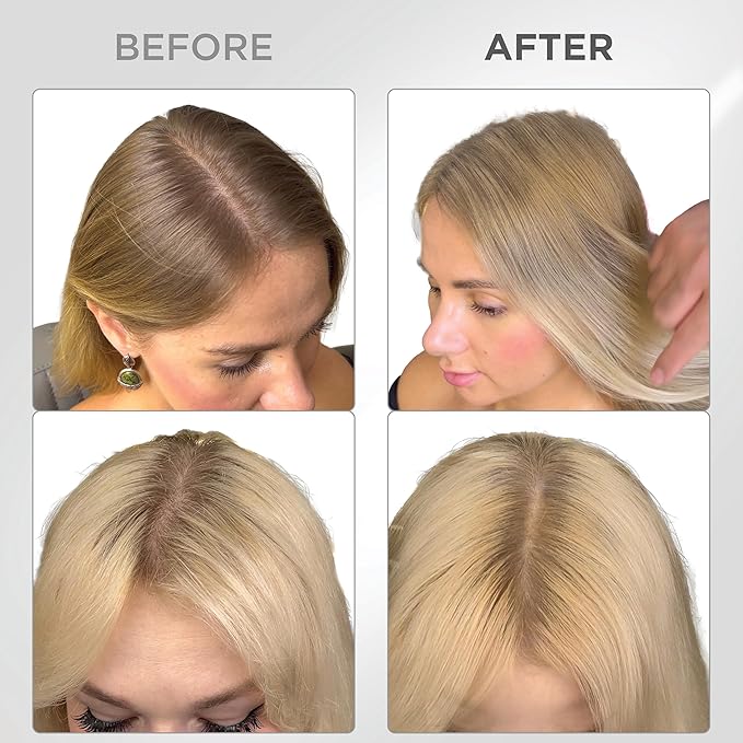 THICK FIBER Root Touch Up Powder with Brush – Covers Grey Roots, Thinning Hair & Bald Spots – Sweat & Water Resistant for Men & Women (Medium Blonde, 0.35 Ounce (Pack of 1))