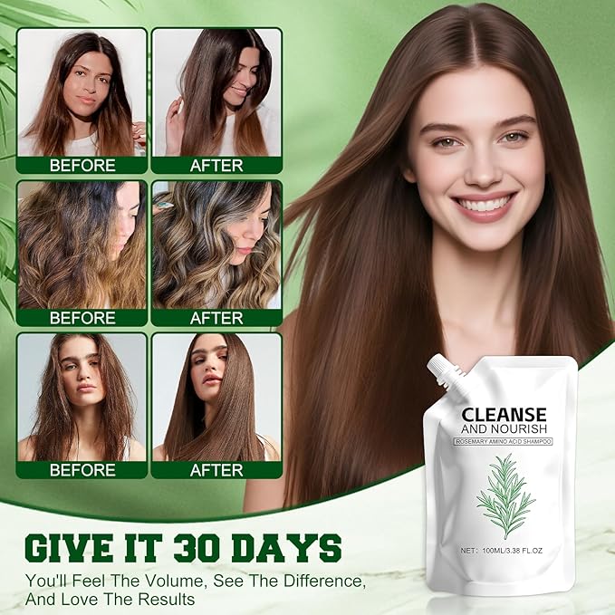 2Pcs Rosemary Amino Acid Shampoo for Hair Growth, Thinning Hair Loss Natural, Moisturizing Hair Shampoo, Strengthening for Men and Women