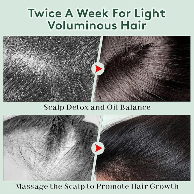 Scalp Scrub, Scalp Exfoliator, Rosemary & Mint Biotin Hair Scrub for Scalp Problems, Dandruff & Dry Scalp Treatment, Clarifying Shampoo with Scalp Scrubber, 9.2oz / 260g