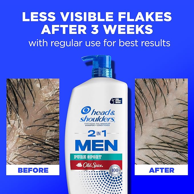 Head & Shoulders Anti-Dandruff Shampoo and Conditioner, Old Spice Pure Sport Men's 2-in-1 Twin Pack, 1% Pyrithione Zinc, Dandruff Shampoo for Men, 31.4 fl oz Each
