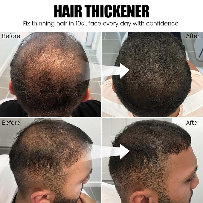 VOLLUCK Hair Thickening Fibers Spray, Temporary Colored Hair Thickener for Root Touch Up Spray, Grey Coverage Root Concealer for Women & Men, | Volumizing & Thickening | Black