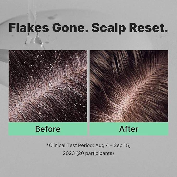 Korean Oil Control Shampoo | Scalp Deep Cleansing Clarifying Shampoo for Thinning Hair, Oily Roots, Volume Boost & Dandruff Care (16.23 fl oz)