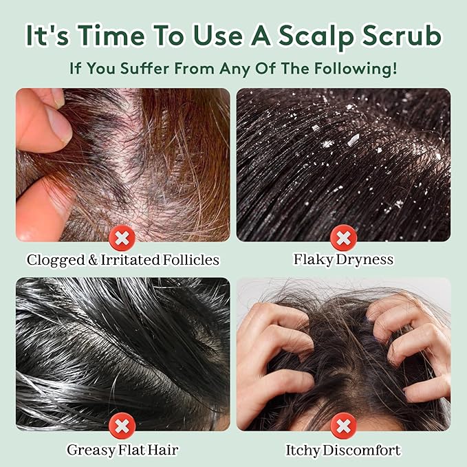 Scalp Scrub, Scalp Exfoliator, Rosemary & Mint Biotin Hair Scrub for Scalp Problems, Dandruff & Dry Scalp Treatment, Clarifying Shampoo with Scalp Scrubber, 9.2oz / 260g