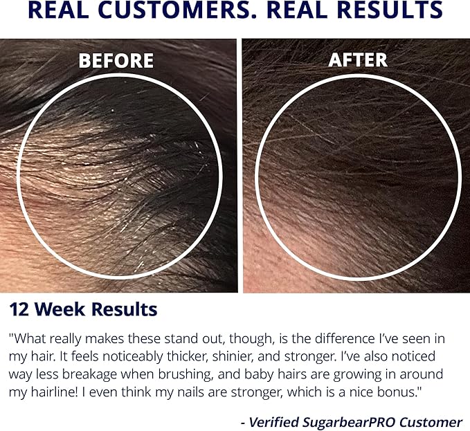 Sugarbear Gentle Detangling Bamboo Hair Brush + Vegan Hair Vitamin Gummies 3 Month Supply, Extra Strength Biotin 6000mcg for Supporting Healthy Straight, Wavy, Curly & Kinky Hair