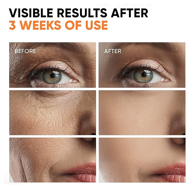 Vitamin C Serum for Face, Stem Cells, Niacinamide, Hyaluronic Acid & Vitamin E – Anti-Aging Retinol Facial Serum with Glycolic Acid & Retinal for Brightening, Hydrating & Firming Skin – Made in USA