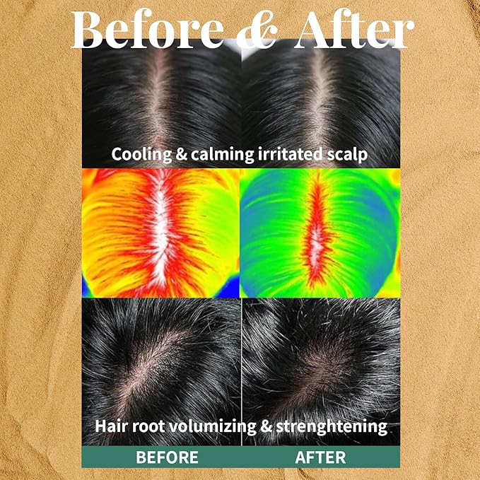 PLU Korean Therapy Scalp Scaling Scrub with Silicone Scalp Massager Brush - Walnut Scalp Scrubber Gel for Oily Scalp and Dandruff - Scalp Exfoliating & Deep Cleansing Combo Set